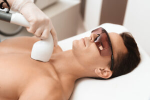 Laser Hair Removal Treatment in Lahore