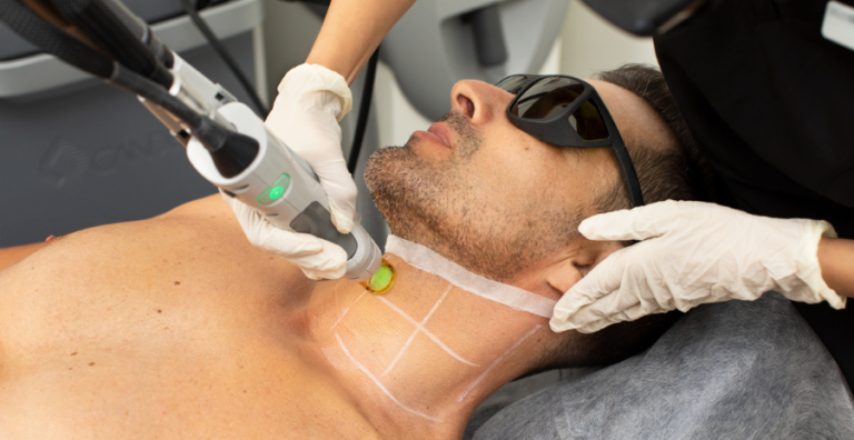 Best Laser Hair Removal in Lahore