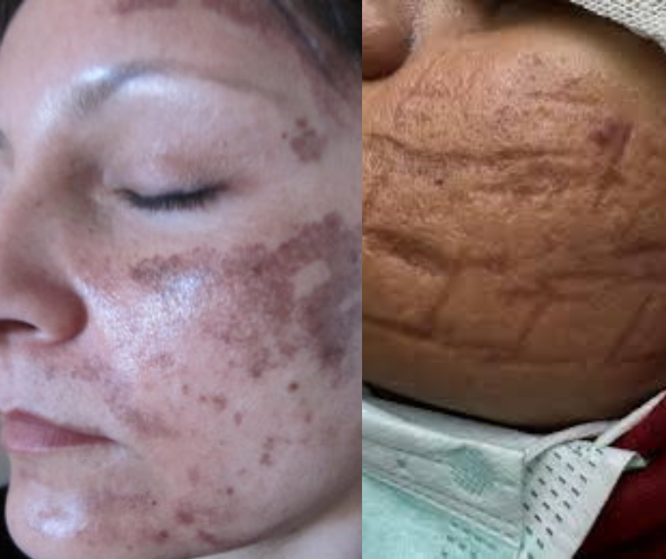 skin care treatment gone wrong